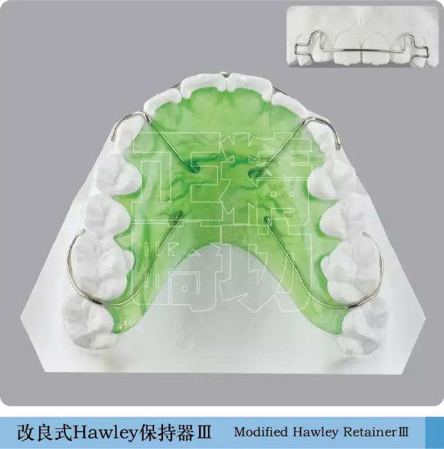 改良式hawley保持器 iii